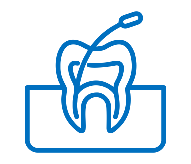Root Canal