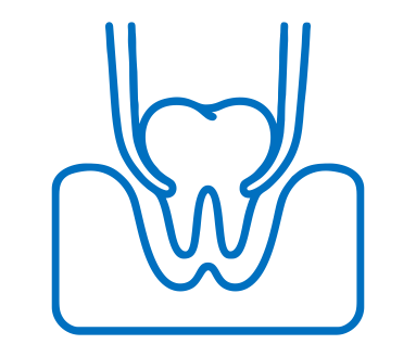 Tooth Extractions
