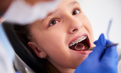 Trusted Orthodontics-Braces